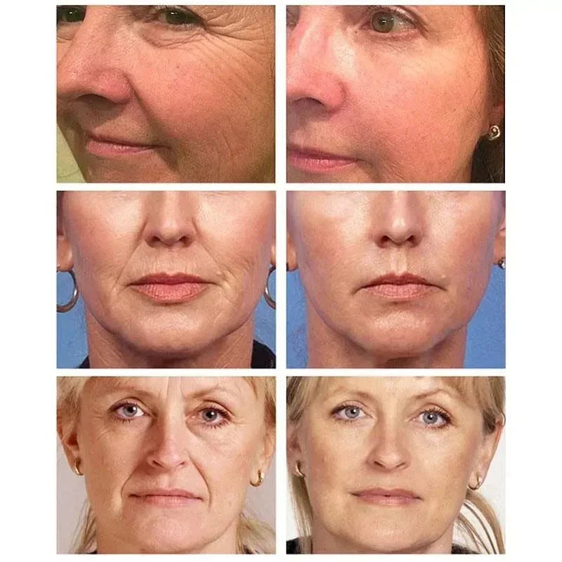 Creme Facial Antirrugas de Arroz Branco – Firmeza, Luminosidade e Hidratação